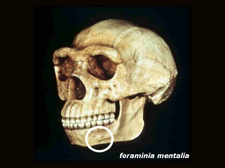 foraminia mentalia 