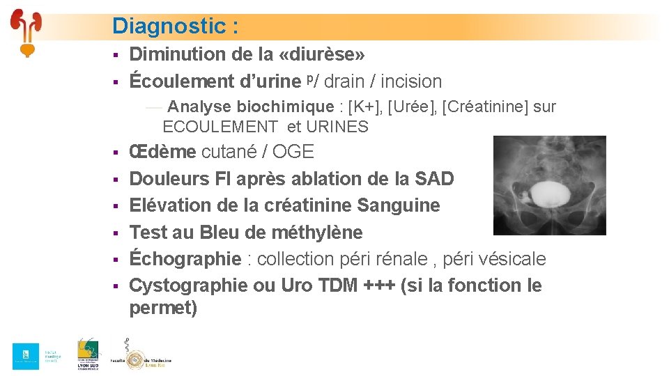 Diagnostic : § § Diminution de la «diurèse» Écoulement d’urine p/ drain / incision