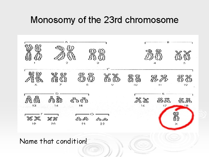 Monosomy of the 23 rd chromosome Name that condition! Monosomy of the 23 rd chromosome Name that condition!