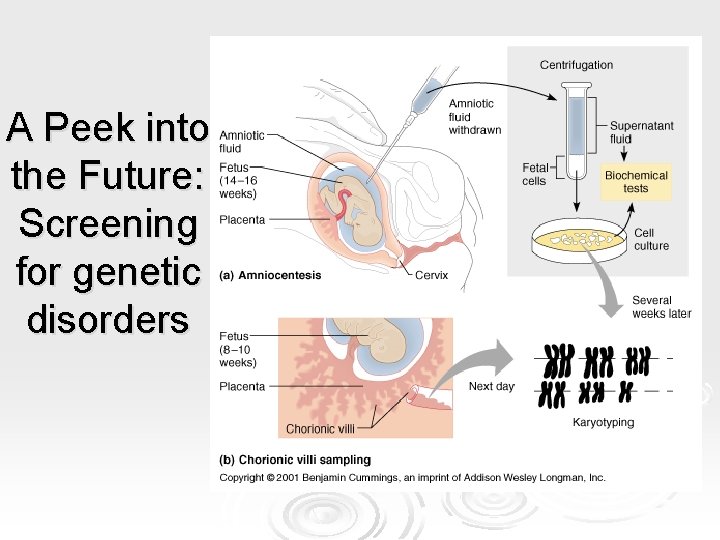 A Peek into the Future: Screening for genetic disorders A Peek into the Future: Screening for genetic disorders