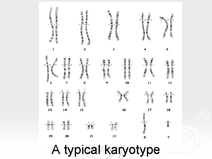 A typical karyotype A typical karyotype