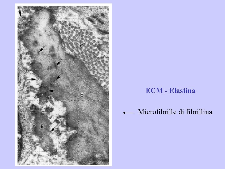 ECM - Elastina Microfibrille di fibrillina 