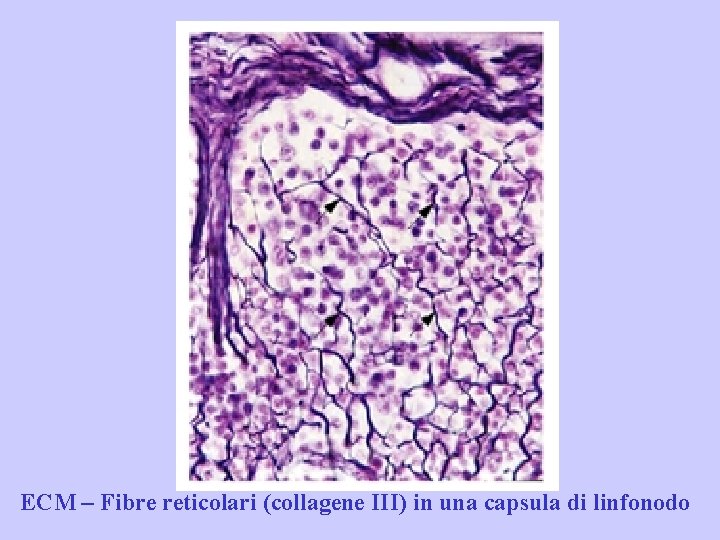 ECM – Fibre reticolari (collagene III) in una capsula di linfonodo 