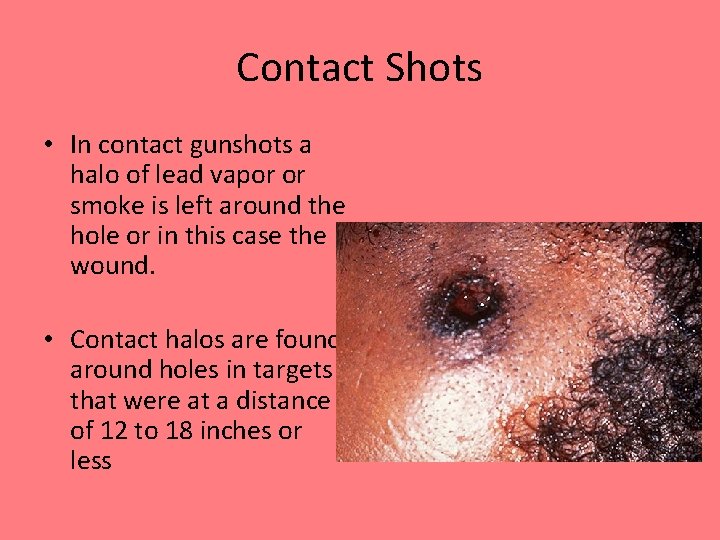 Contact Shots • In contact gunshots a halo of lead vapor or smoke is