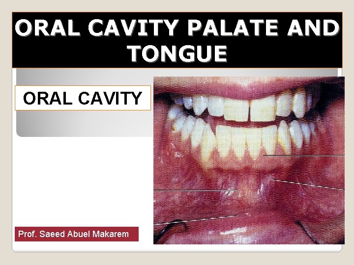 ORAL CAVITY PALATE AND TONGUE ORAL CAVITY Prof. Saeed Abuel Makarem 