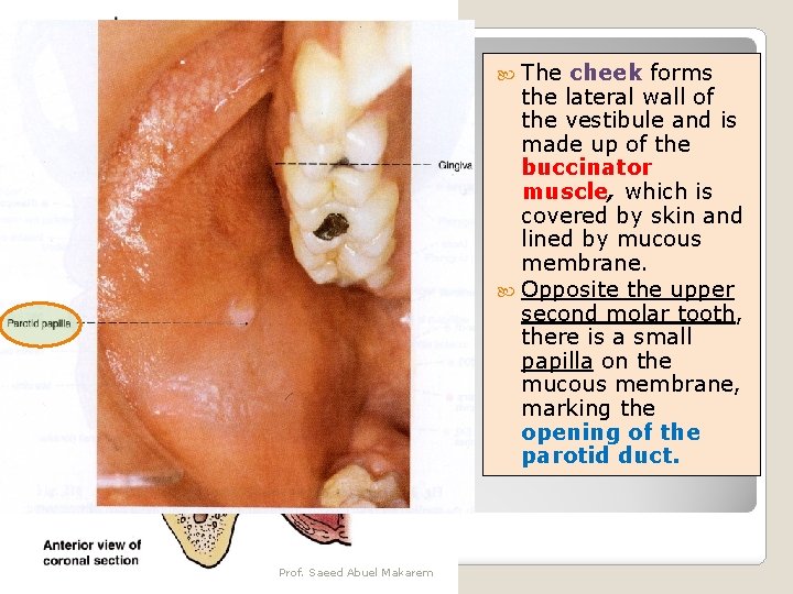  The cheek forms the lateral wall of the vestibule and is made up