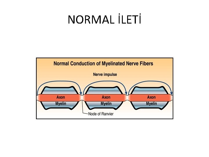 NORMAL İLETİ 