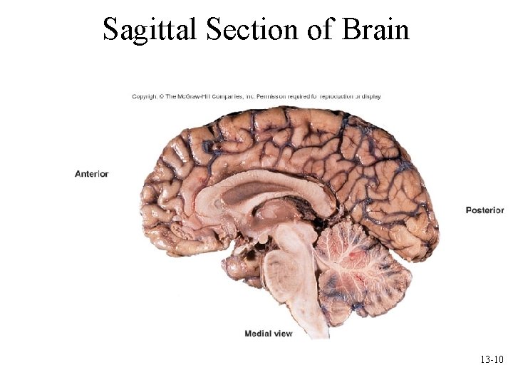 Sagittal Section of Brain 13 -10 