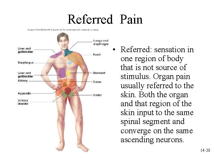 Referred Pain • Referred: sensation in one region of body that is not source