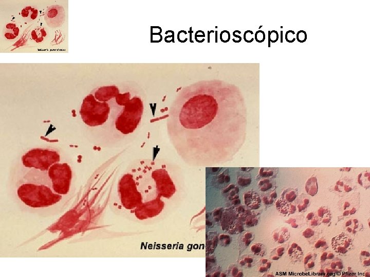 Bacterioscópico 