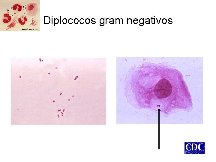Diplococos gram negativos 