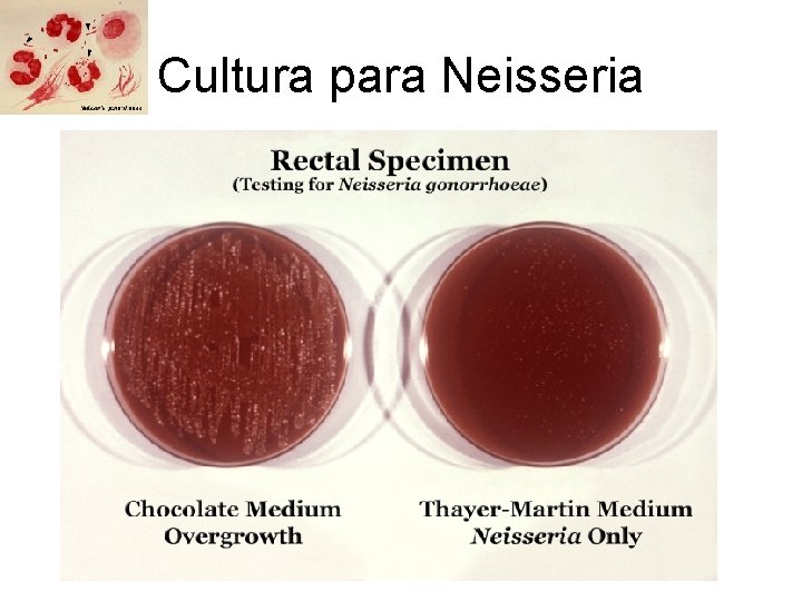 Cultura para Neisseria 