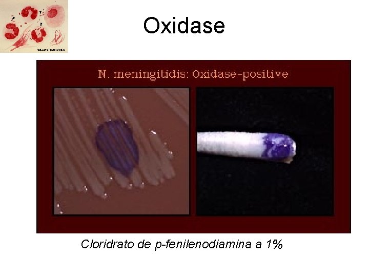 Oxidase Cloridrato de p-fenilenodiamina a 1% 