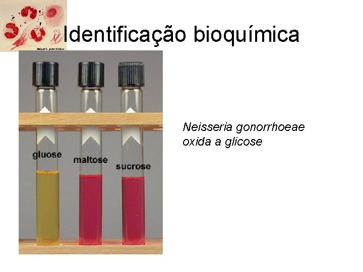 Identificação bioquímica Neisseria gonorrhoeae oxida a glicose 