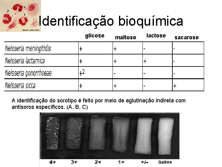 Identificação bioquímica glicose maltose lactose sacarose A identificação do sorotipo é feito por meio
