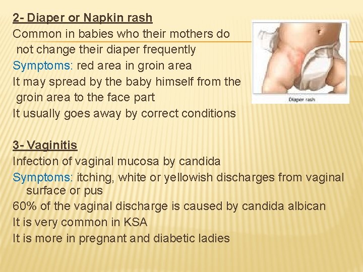 2 - Diaper or Napkin rash Common in babies who their mothers do not