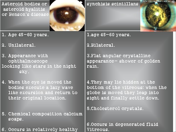 Asteroid bodies or asteroid hyalitis or Benson's disease synchisis scintillans 1. Age 45 -60 Asteroid bodies or asteroid hyalitis or Benson's disease synchisis scintillans 1. Age 45 -60