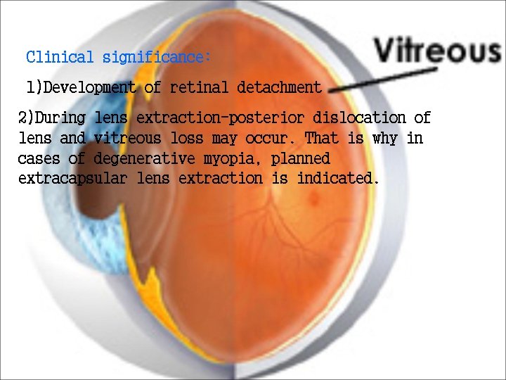 Clinical significance: 1)Development of retinal detachment 2)During lens extraction-posterior dislocation of lens and vitreous Clinical significance: 1)Development of retinal detachment 2)During lens extraction-posterior dislocation of lens and vitreous