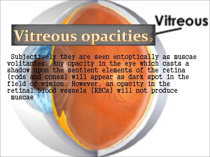 Vitreous opacities: Subjectively they are seen entoptically as muscae volitantes. Any opacity in the Vitreous opacities: Subjectively they are seen entoptically as muscae volitantes. Any opacity in the