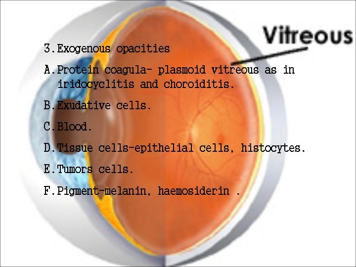 3. Exogenous opacities A. Protein coagula- plasmoid vitreous as in iridocyclitis and choroiditis. B. 3. Exogenous opacities A. Protein coagula- plasmoid vitreous as in iridocyclitis and choroiditis. B.