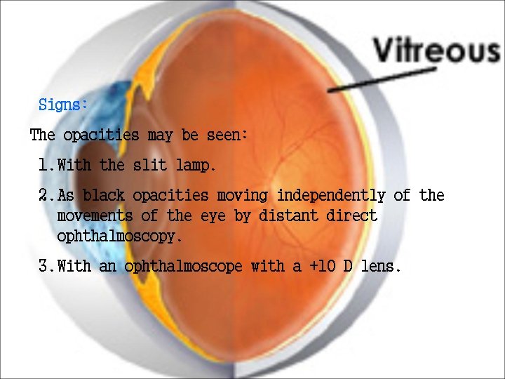 Signs: The opacities may be seen: 1. With the slit lamp. 2. As black Signs: The opacities may be seen: 1. With the slit lamp. 2. As black
