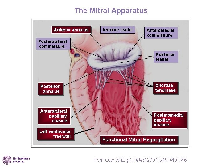 The Mitral Apparatus Anterior annulus Anterior leaflet Anteromedial commissure Posterolateral commissure Posterior leaflet Posterior