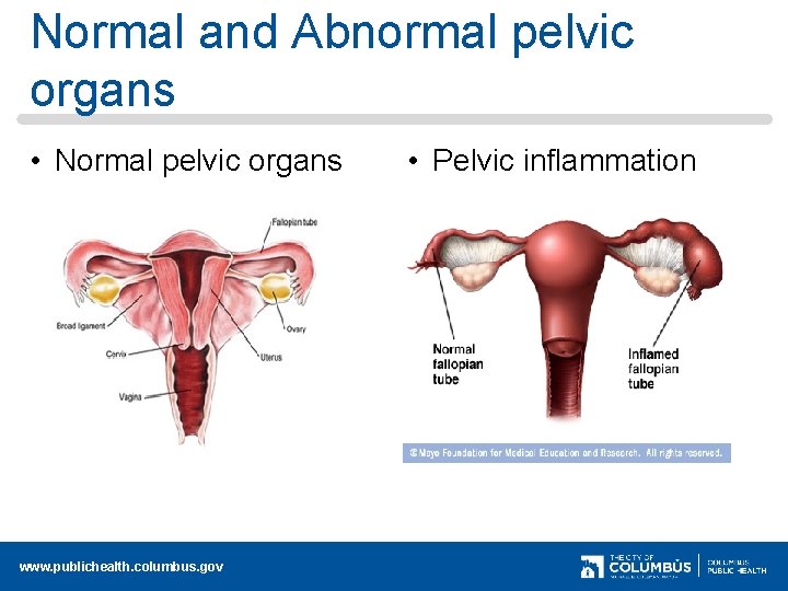 Normal and Abnormal pelvic organs • Normal pelvic organs www. publichealth. columbus. gov •