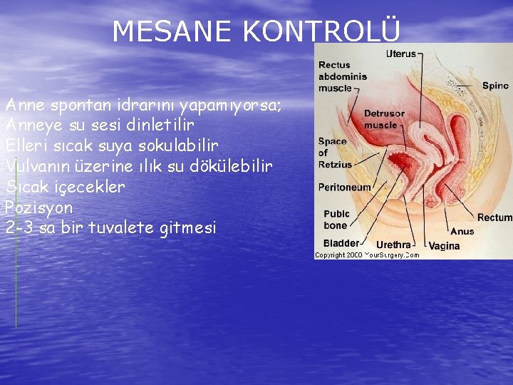 MESANE KONTROLÜ Anne spontan idrarını yapamıyorsa; Anneye su sesi dinletilir Elleri sıcak suya sokulabilir