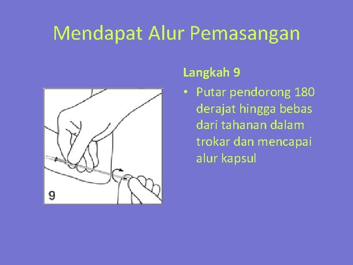 Mendapat Alur Pemasangan Langkah 9 • Putar pendorong 180 derajat hingga bebas dari tahanan