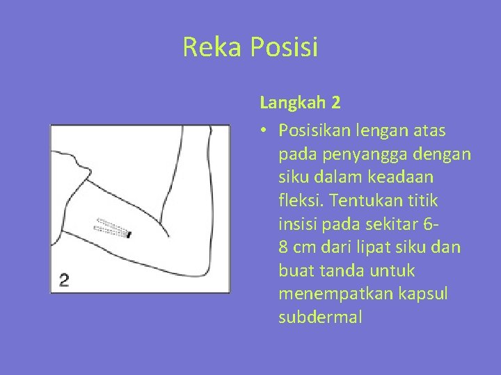 Reka Posisi Langkah 2 • Posisikan lengan atas pada penyangga dengan siku dalam keadaan