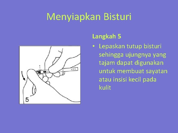 Menyiapkan Bisturi Langkah 5 • Lepaskan tutup bisturi sehingga ujungnya yang tajam dapat digunakan