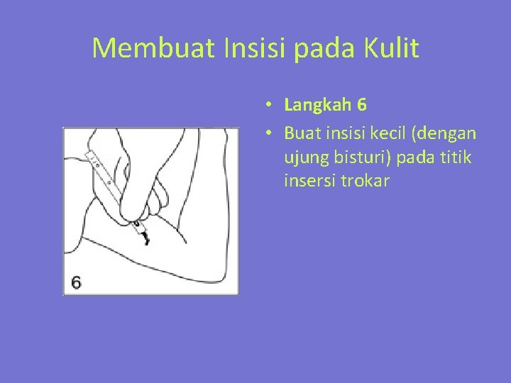 Membuat Insisi pada Kulit • Langkah 6 • Buat insisi kecil (dengan ujung bisturi)