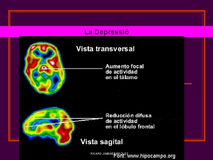 La Depressió RICARD JIMENEZ EROLES Font: www. hipocampo. org 