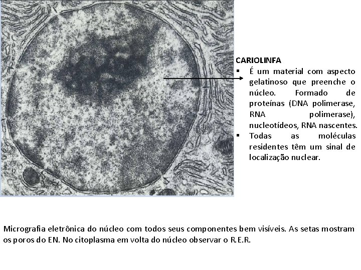 CARIOLINFA § É um material com aspecto gelatinoso que preenche o núcleo. Formado de