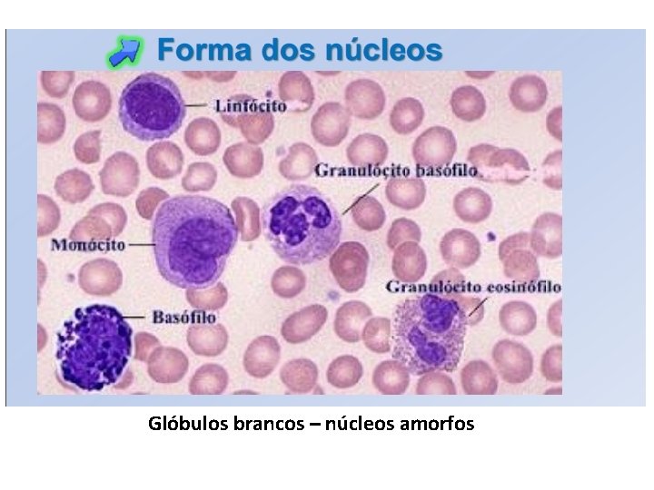 Glóbulos brancos – núcleos amorfos 