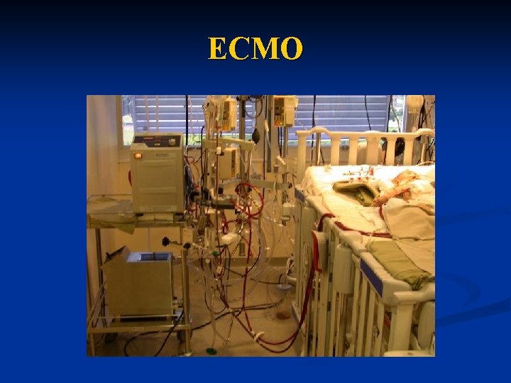 ECMO 