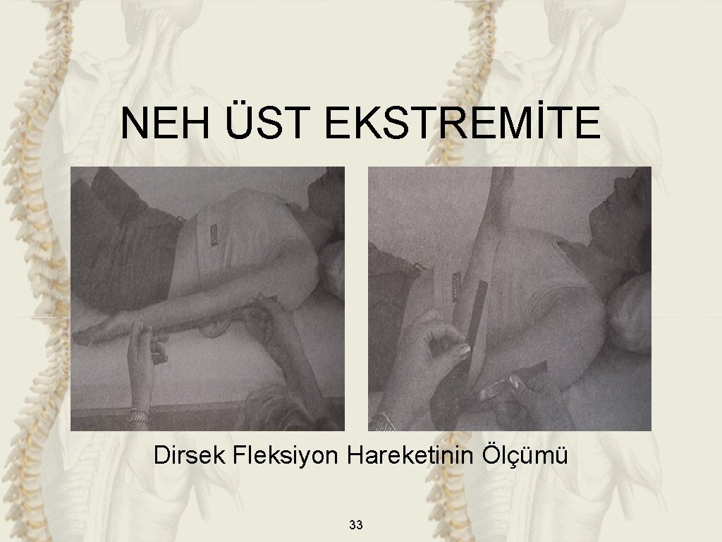 NEH ÜST EKSTREMİTE Dirsek Fleksiyon Hareketinin Ölçümü 33 NEH ÜST EKSTREMİTE Dirsek Fleksiyon Hareketinin Ölçümü 33