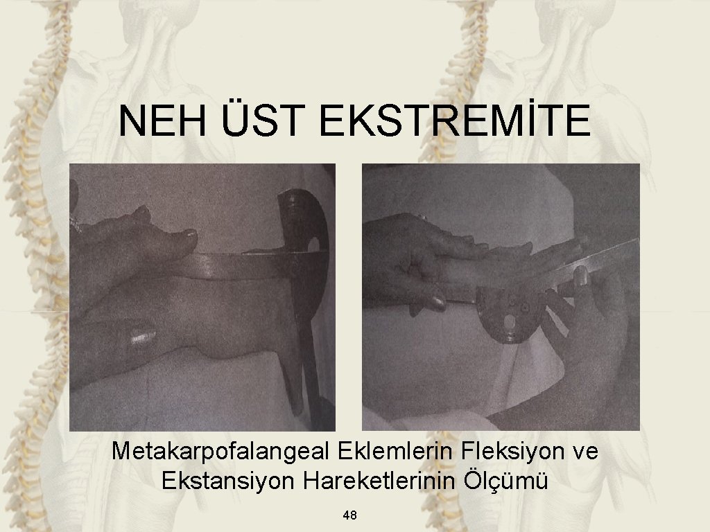 NEH ÜST EKSTREMİTE Metakarpofalangeal Eklemlerin Fleksiyon ve Ekstansiyon Hareketlerinin Ölçümü 48 NEH ÜST EKSTREMİTE Metakarpofalangeal Eklemlerin Fleksiyon ve Ekstansiyon Hareketlerinin Ölçümü 48