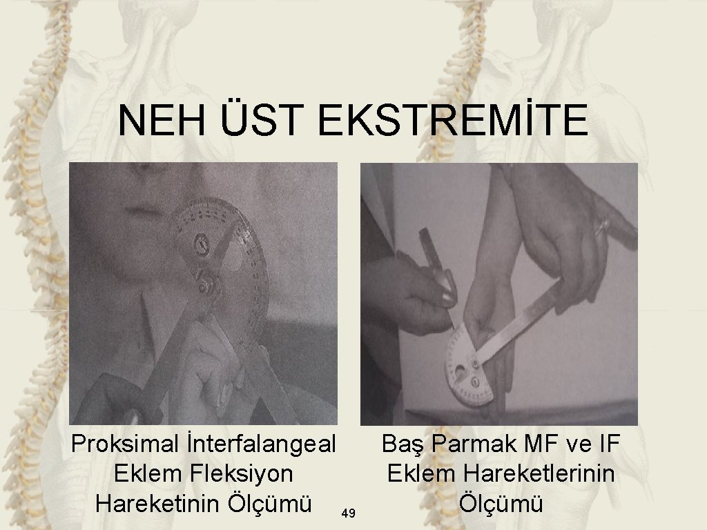 NEH ÜST EKSTREMİTE Proksimal İnterfalangeal Eklem Fleksiyon Hareketinin Ölçümü 49 Baş Parmak MF ve NEH ÜST EKSTREMİTE Proksimal İnterfalangeal Eklem Fleksiyon Hareketinin Ölçümü 49 Baş Parmak MF ve