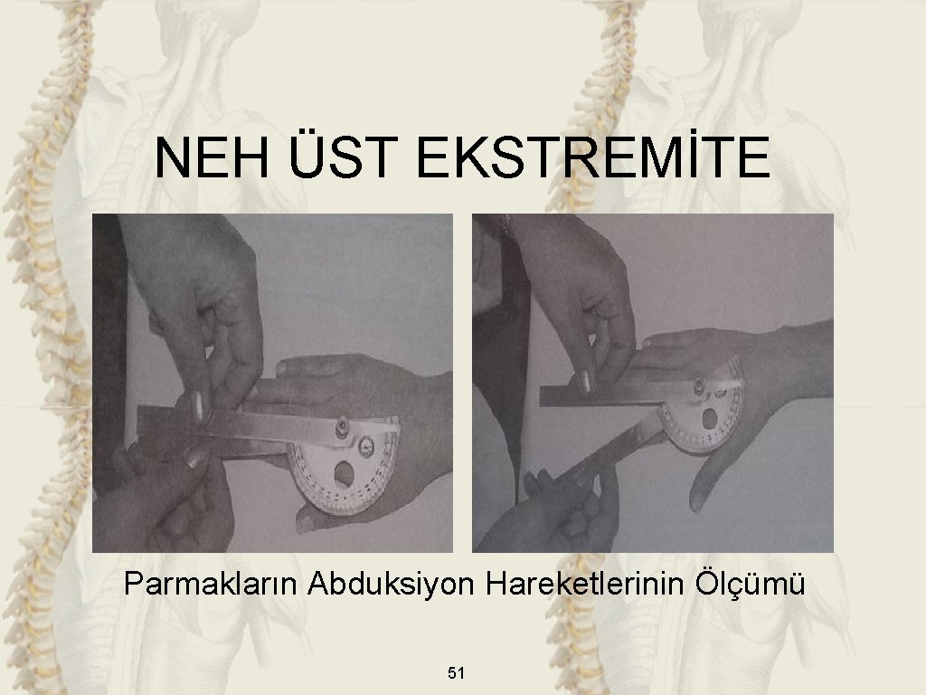 NEH ÜST EKSTREMİTE Parmakların Abduksiyon Hareketlerinin Ölçümü 51 NEH ÜST EKSTREMİTE Parmakların Abduksiyon Hareketlerinin Ölçümü 51