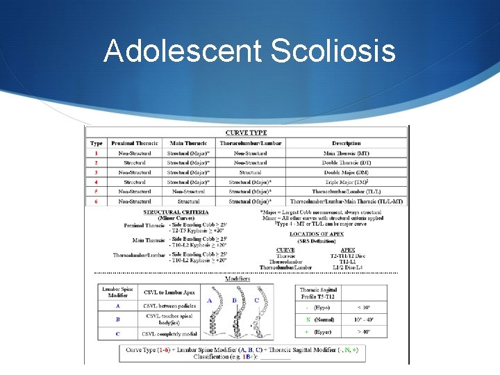 Adolescent Scoliosis 