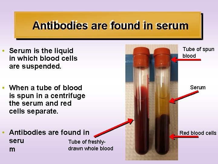 Antibodies are found in serum • Serum is the liquid in which blood cells