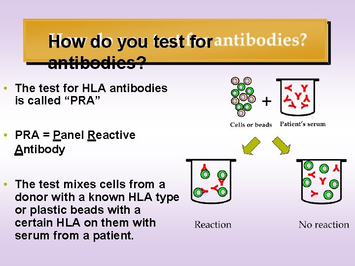 How do you test for antibodies? • The test for HLA antibodies is called