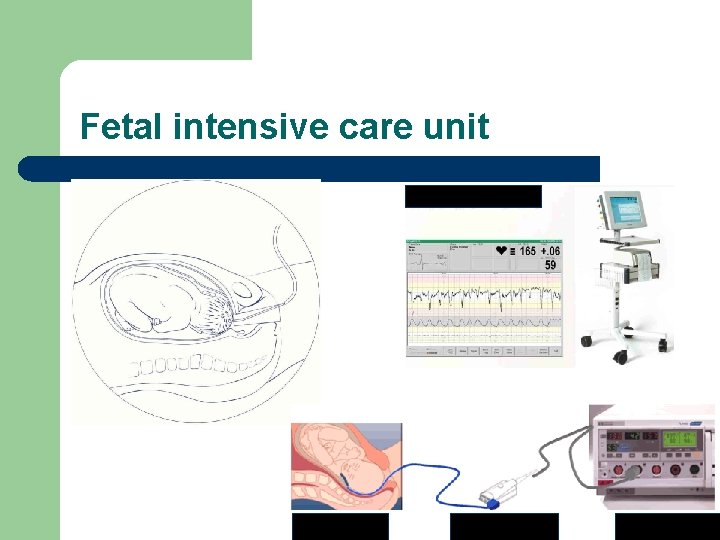 Fetal intensive care unit 