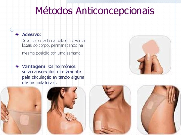  Métodos Anticoncepcionais Adesivo: Deve ser colado na pele em diversos locais do corpo,