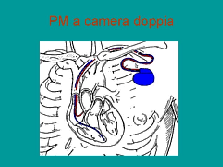 PM a camera doppia 