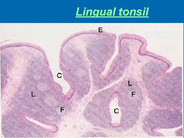 Lingual tonsil 