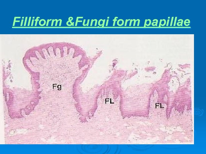 Filliform &Fungi form papillae 