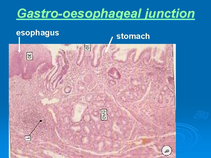 Gastro-oesophageal junction esophagus stomach 