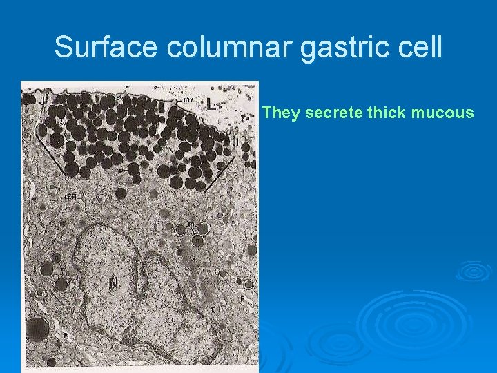 Surface columnar gastric cell They secrete thick mucous 